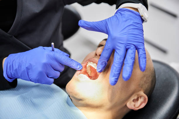 Best Emergency Dental Care for Broken or Chipped Teeth in Sneads, FL
